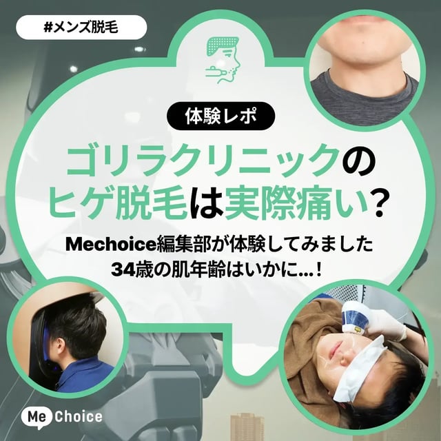 【体験レポ】ゴリラクリニックのヒゲ脱毛は実際痛いの？Mechoice編集部が体験してみた